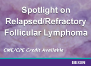Spotlight on Relapsed/Refractory Follicular Lymphoma