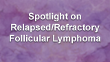 Spotlight on Relapsed/Refractory Follicular Lymphoma 